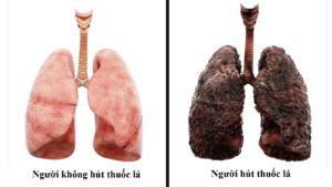 Tác hại của khói thuốc